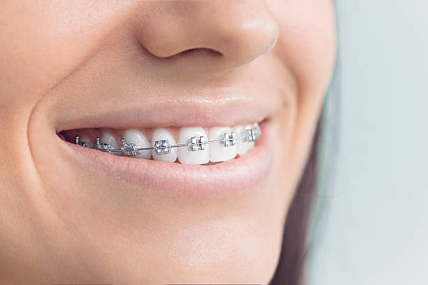 Best Tooth Extraction  in Montevideo, MN